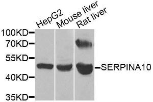 Western blot analysis of extracts of various cell lines, using SERPINA10 antibody. (SERPINA10 抗体  (AA 165-444))