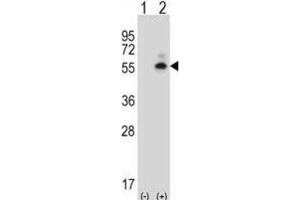 Western Blotting (WB) image for anti-Calcium/calmodulin-Dependent Protein Kinase II delta (CAMK2D) antibody (ABIN2997546) (CAMK2D 抗体)