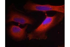 Immunofluorescence staining of methanol-fixed Hela cells using Keratin 8(Phospho-Ser74) Antibody. (KRT8 抗体  (pSer74))