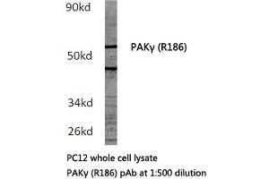 Western blot (WB) analysis of PAKγ antibody in extracts from PC12 cells.