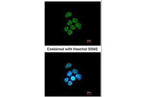 ICC/IF Image Immunofluorescence analysis of paraformaldehyde-fixed A431, using hnRNP K, antibody at 1:200 dilution. (HNRNPK 抗体)
