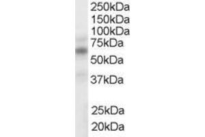 ABIN185294 (1µg/ml) staining of human spleen lysate (35µg protein in RIPA buffer).