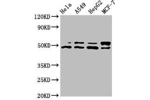 Western Blot Positive WB detected in: Hela whole cell lysate, A549 whole cell lysate, HepG2 whole cell lysate, MCF-7 whole cell lysate All lanes: AKT1 antibody at 7.