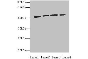 Western blot All lanes: ETNK1 antibody at 0. (Ethanolamine Kinase 1 抗体  (AA 90-258))