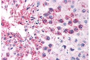 Human Testis (formalin-fixed, paraffin-embedded) stained with TFF2 antibody ABIN351426 at 15 ug/ml followed by biotinylated goat anti-rabbit IgG secondary antibody ABIN481713, alkaline phosphatase-streptavidin and chromogen. (Trefoil Factor 2 抗体  (Internal Region))