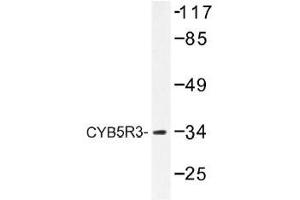 Image no. 2 for anti-Cytochrome B5 Reductase 3 (CYB5R3) antibody (ABIN317921) (CYB5R3 抗体)