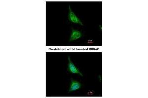 ICC/IF Image Immunofluorescence analysis of methanol-fixed HeLa, using Aladin, antibody at 1:500 dilution. (Adracalin 抗体  (Internal Region))