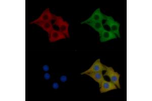 PKD1/PKC mu Mouse Monoclonal Antibody staining Hela cells by IF/ICC. (PKC mu 抗体)