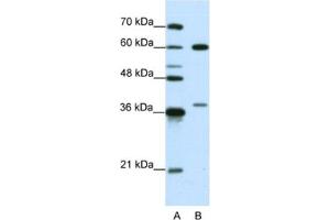 Western Blotting (WB) image for anti-Heterogeneous Nuclear Ribonucleoprotein L (HNRNPL) antibody (ABIN2462110) (HNRNPL 抗体)