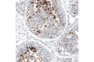 Immunohistochemical staining (Formalin-fixed paraffin-embedded sections) of human testis shows strong positivity in a subset of cells in seminiferous tubules. (CXORF61 抗体)