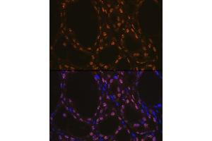 Immunofluorescence analysis of rat thyroid using TTF1 Rabbit mAb (ABIN1679475, ABIN3017648, ABIN3017649 and ABIN7101514) at dilution of 1:100 (40x lens). (NKX2-1 抗体)