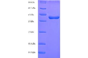 SDS-PAGE (SDS) image for WNT1 Inducible Signaling Pathway Protein 2 (WISP2) (AA 24-251) protein (His-SUMO Tag) (ABIN5711991)
