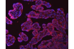 IF analysis of SRPRA using anti-SRPRA antibody (ABIN7601408). (SRPRA (AA 346-638) 抗体)