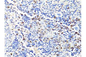 Immunohistochemistry of paraffin-embedded mouse spleen using S100A9 antibody. (S100A9 抗体)
