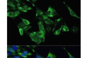 Immunofluorescence analysis of U2OS cells using PMEPA1 Polyclonal Antibody at dilution of 1:100. (PMEPA1 抗体)