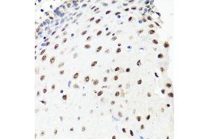 Immunohistochemistry (Paraffin-embedded Sections) (IHC (p)) image for anti-PRP8 Pre-mRNA Processing Factor 8 (PRPF8) (AA 1-100) antibody (ABIN6146268)