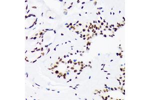 Immunohistochemistry (IHC) image for anti-Ligase I, DNA, ATP-Dependent (LIG1) antibody (ABIN7268251)