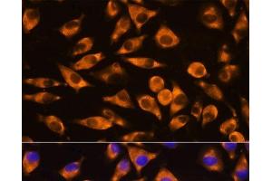 Immunofluorescence analysis of L929 cells using CEP55 Polyclonal Antibody at dilution of 1:100. (CEP55 抗体)