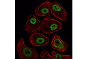 Immunofluorescence analysis of NIH/3T3 cells using SMC1 mouse mAb (green). (SMC1A 抗体)