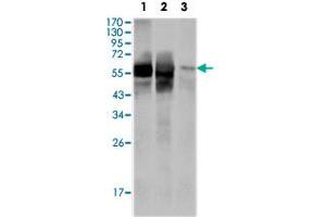 Western blot analysis using GPI monoclonal antobody, clone 1B7D7  against HepG2 (1) , SMMC-7721 (2) cell lysate and rat liver tissue lysate (3). (GPI 抗体)