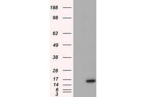 HEK293T cells were transfected with the pCMV6-ENTRY control (Left lane) or pCMV6-ENTRY BIRC5 (Right lane) cDNA for 48 hrs and lysed. (Survivin 抗体)