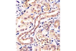 (ABIN6242571 and ABIN6578501) staining KCTD11 in human kidney tissue sections by Immunohistochemistry (IHC-P - paraformaldehyde-fixed, paraffin-embedded sections). (KCTD11 抗体  (AA 21-53))