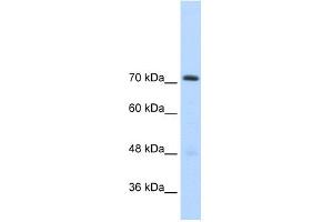 WB Suggested Anti-GTF2IRD1 Antibody Titration:  2. (GTF2IRD1 抗体  (C-Term))