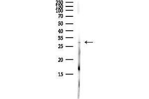 Western blot analysis of lysates from Hela cells(starvation,24h treatment), using DNAJC5 Antibody at 1/1000 dilution.