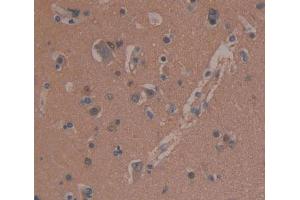 IHC-P analysis of brain tissue, with DAB staining. (MAP1B 抗体  (AA 2207-2468))