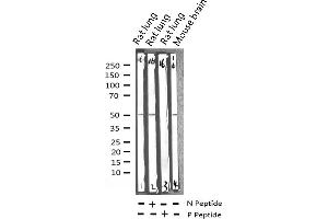 Western Blotting (WB) image for anti-Calcium/calmodulin-Dependent Protein Kinase II beta (CAMK2B) (pThr286) antibody (ABIN6256533)
