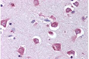 Human Brain, Cortex (formalin-fixed, paraffin-embedded) stained with RELA antibody ABIN218582 at 1:500 followed by biotinylated goat anti-rabbit IgG secondary antibody ABIN481713, alkaline phosphatase-streptavidin and chromogen. (NF-kB p65 抗体  (pSer529))