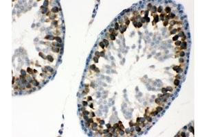 IHC testing of FFPE rat testis with YB1 antibody. (YBX1 抗体)