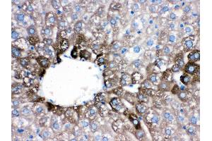 Immunohistochemistry (IHC) image for anti-Cytochrome P450, Family 1, Subfamily A, Polypeptide 2 (CYP1A2) (AA 185-320) antibody (ABIN3043820)
