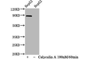 Western Blot Positive WB detected in HepG2 whole cell lysate(treated with Calyculin A or not) All lanes Phospho-STAT1 antibody at 1. (Recombinant STAT1 抗体  (pSer727))