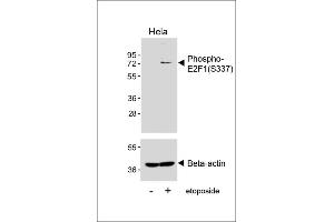 Western blot analysis of lysates from Hela cell line, untreated or treated with etoposide(25μM, 24h), using Phospho-E2F1 Antibody (upper) or Beta-actin (lower). (E2F1 抗体  (pSer337))