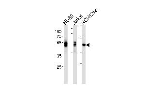 LCK Antibody ABIN1882258 western blot analysis in HL-60,Jurkat,NCI- cell line lysates (35 μg/lane). (LCK 抗体)