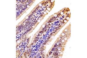 Immunohistochemistry (Paraffin-embedded Sections) (IHC (p)) image for anti-Nuclear Apoptosis Inducing Factor 1 (NAIF1) antibody (ABIN7074867)