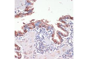 Immunohistochemistry of paraffin-embedded rat lung using Musashi-1 (Musashi-1 (MSI1)) antibody (ABIN6134835, ABIN6144067, ABIN6144068 and ABIN6219720) at dilution of 1:200 (40x lens). (MSI1 抗体  (AA 1-100))