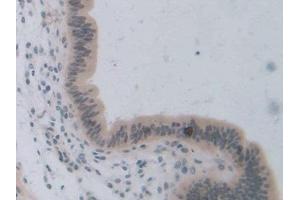 Detection of TCF20 in Mouse Uterus Tissue using Polyclonal Antibody to Transcription factor 20 (TCF20)