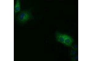 Immunofluorescence (IF) image for anti-Short Chain Dehydrogenase/reductase Family 9C, Member 7 (SDR9C7) antibody (ABIN1500840) (SDR9C7 抗体)