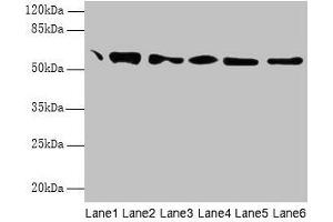 Western blot All lanes: P4HB antibody at 1. (P4HB 抗体  (AA 29-508))
