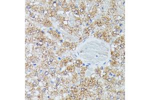 Immunohistochemistry of paraffin-embedded rat liver using IVD antibody (ABIN7268031) at dilution of 1:100 (40x lens). (IVD 抗体  (AA 33-200))