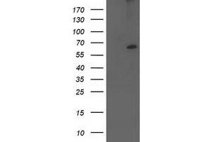 Western Blotting (WB) image for anti-Cytochrome P450, Family 2, Subfamily J, Polypeptide 2 (CYP2J2) antibody (ABIN1497729) (CYP2J2 抗体)