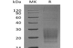 Western Blotting (WB) image for Inducible T-Cell Co-Stimulator (ICOS) protein (His tag) (ABIN7320718)