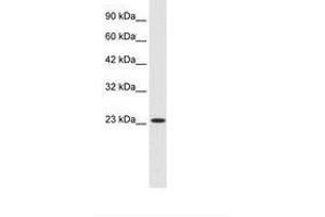 Image no. 2 for anti-Kv Channel Interacting Protein 2 (KCNIP2) (AA 22-71) antibody (ABIN6735459) (KCNIP2 抗体  (AA 22-71))