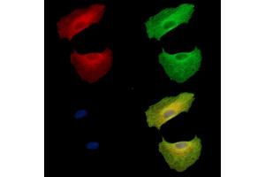 ABIN7095041 and ABIN7099097 staining  cells by IF/ICC. (SBEM 抗体)