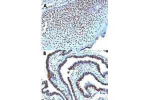 Immunohistochemical staining (Formalin-fixed paraffin-embedded sections) of human tonsil (A) and human ovarian carcinoma (B) with Histone H1 monoclonal antibody, clone AE-4 . (Histone H1 抗体)