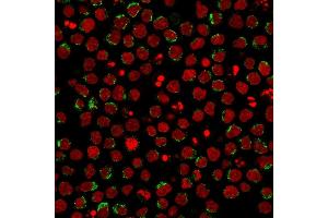 Immunofluorescent staining of PFA-fixed Ramos cells using CD5-Monospecific Mouse Monoclonal Antibody (CD5/2416) followed by goat anti-Mouse IgG conjugated to CF488 (green).