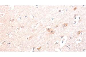 Immunohistochemistry of paraffin-embedded Human brain using TRAF3IP1 Polyclonal Antibody at dilution of 1:70 (TRAF3IP1 抗体)