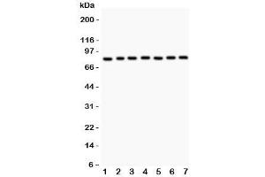 Western blot testing of MAD1 antibody and human samples 1:  A549;  2: Jurkat;  3: HeLa;  4: 293T;  5: SHG-44;  6: 22RV1;  7: PANC lysate.